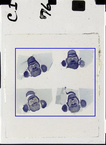 Media type: image; Special Collections 3298   shows specimen_part histological serial section;